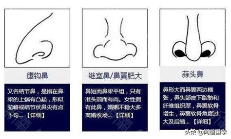 沒有鼻梁 面相|相術中的鼻觀